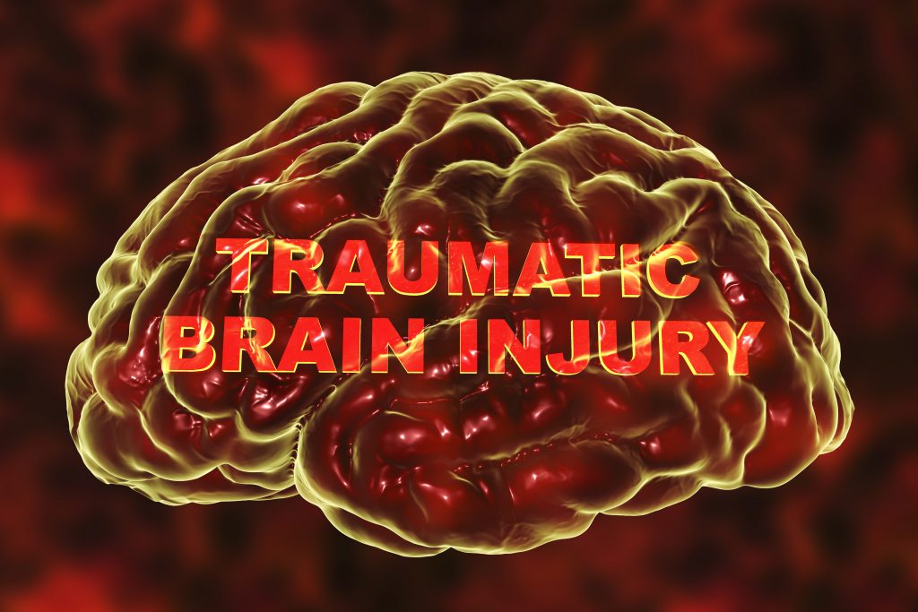 The Different Types of Traumatic Brain Injury (TBI)