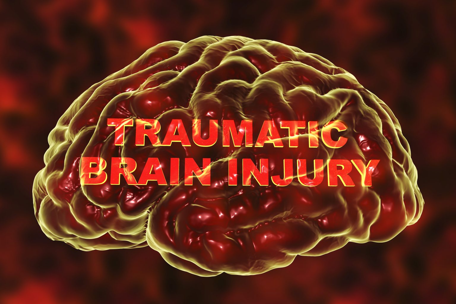 the-different-types-of-traumatic-brain-injury-tbi-virk-personal